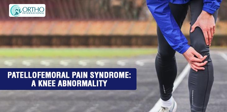 Patellofemoral Pain Syndrome: A Knee Abnormality