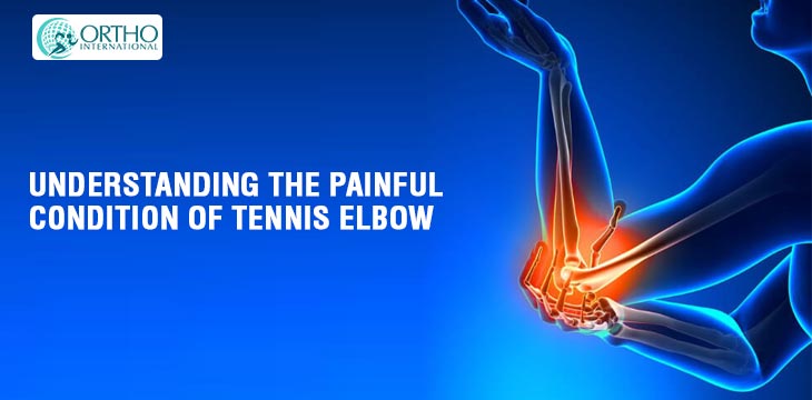 Understanding The Painful Condition Of Tennis Elbow